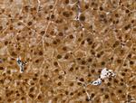 CDK8 Antibody in Immunohistochemistry (Paraffin) (IHC (P))