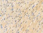 CDK8 Antibody in Immunohistochemistry (Paraffin) (IHC (P))