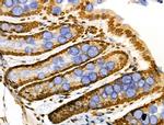 CDK8 Antibody in Immunohistochemistry (Paraffin) (IHC (P))