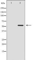 CDK8 Antibody in Western Blot (WB)