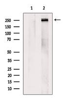 CELSR2 Antibody in Western Blot (WB)