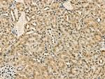 CENPB Antibody in Immunohistochemistry (Paraffin) (IHC (P))