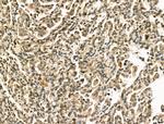 CENPB Antibody in Immunohistochemistry (Paraffin) (IHC (P))