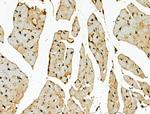 CENPB Antibody in Immunohistochemistry (Paraffin) (IHC (P))