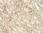 CENPB Antibody in Immunohistochemistry (Paraffin) (IHC (P))