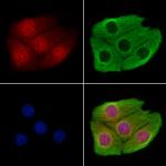 CHD4 Antibody in Immunocytochemistry (ICC/IF)