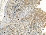 CHD4 Antibody in Immunohistochemistry (Paraffin) (IHC (P))