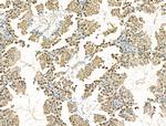 CHD4 Antibody in Immunohistochemistry (Paraffin) (IHC (P))