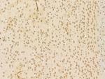 CHD4 Antibody in Immunohistochemistry (Paraffin) (IHC (P))