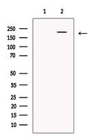 CHD4 Antibody in Western Blot (WB)