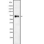 CHRNA4 Antibody in Western Blot (WB)