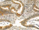 Clathrin Heavy Chain Antibody in Immunohistochemistry (Paraffin) (IHC (P))