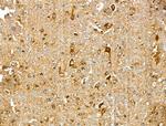 Clathrin Heavy Chain Antibody in Immunohistochemistry (Paraffin) (IHC (P))