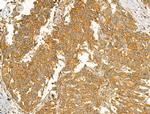 Clathrin Heavy Chain Antibody in Immunohistochemistry (Paraffin) (IHC (P))