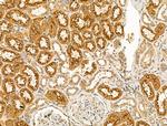 Clathrin Heavy Chain Antibody in Immunohistochemistry (Paraffin) (IHC (P))