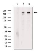 Clathrin Heavy Chain Antibody in Western Blot (WB)