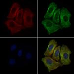 CLCN2 Antibody in Immunocytochemistry (ICC/IF)