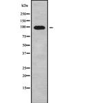 CLCN2 Antibody in Western Blot (WB)