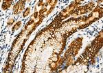 CLPP Antibody in Immunohistochemistry (Paraffin) (IHC (P))