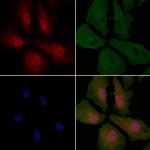 Cofilin 1/2 Antibody in Immunocytochemistry (ICC/IF)