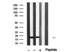 Cofilin 1/2 Antibody in Western Blot (WB)