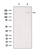 COL11A1 Antibody in Western Blot (WB)