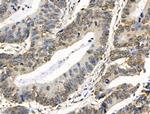 COPS2 Antibody in Immunohistochemistry (Paraffin) (IHC (P))