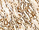 COPS2 Antibody in Immunohistochemistry (Paraffin) (IHC (P))