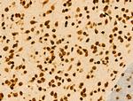 COPS2 Antibody in Immunohistochemistry (Paraffin) (IHC (P))