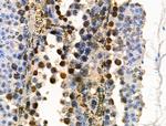 COPS2 Antibody in Immunohistochemistry (Paraffin) (IHC (P))