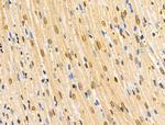 COPS2 Antibody in Immunohistochemistry (Paraffin) (IHC (P))