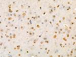 COPS2 Antibody in Immunohistochemistry (Paraffin) (IHC (P))