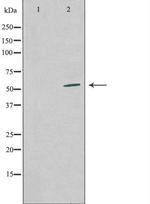 COPS2 Antibody in Western Blot (WB)