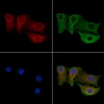 CPEB4 Antibody in Immunocytochemistry (ICC/IF)