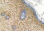 CRABP2 Antibody in Immunohistochemistry (Paraffin) (IHC (P))