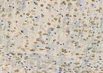 CRABP2 Antibody in Immunohistochemistry (Paraffin) (IHC (P))