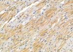 CRABP2 Antibody in Immunohistochemistry (Paraffin) (IHC (P))