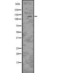 CSF2RB Antibody in Western Blot (WB)