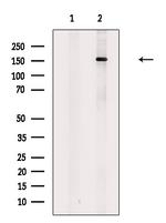 CUX1 Antibody in Western Blot (WB)