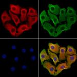 CXCL16 Antibody in Immunocytochemistry (ICC/IF)