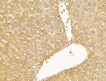 CXCL16 Antibody in Immunohistochemistry (Paraffin) (IHC (P))