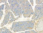 CXCL16 Antibody in Immunohistochemistry (Paraffin) (IHC (P))