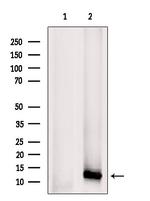 CXCL5 Antibody in Western Blot (WB)