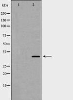 Cyclin D2 Antibody in Western Blot (WB)