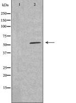 CYP26A1 Antibody in Western Blot (WB)