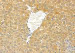 CYP2D6 Antibody in Immunohistochemistry (Paraffin) (IHC (P))