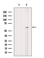 CYP46A1 Antibody in Western Blot (WB)