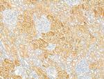 DYNC1I1 Antibody in Immunohistochemistry (Paraffin) (IHC (P))