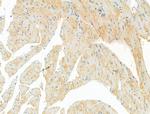 DYNC1I1 Antibody in Immunohistochemistry (Paraffin) (IHC (P))