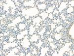 DYNC1I1 Antibody in Immunohistochemistry (Paraffin) (IHC (P))